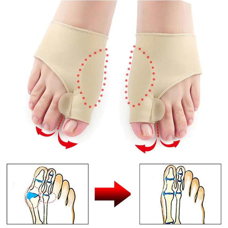 Corretor de Joanetes Hallux Valgus, Endireitador de Dedos em Martelo, Alívio da Dor nos Pés, Ferramentas Ortopédicas para Pedicure e Cuidados com os Pés