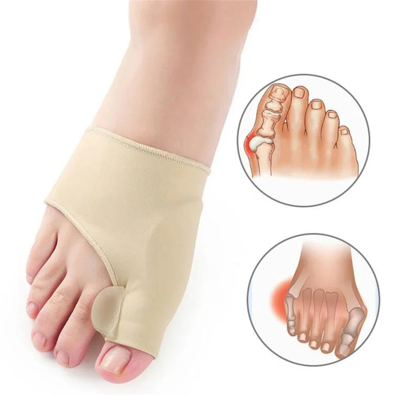 Corretor de Joanetes Hallux Valgus, Endireitador de Dedos em Martelo, Alívio da Dor nos Pés, Ferramentas Ortopédicas para Pedicure e Cuidados com os Pés